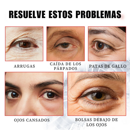 (COMPRA Y GANA) Ouho™ Serum Quita Ojeras