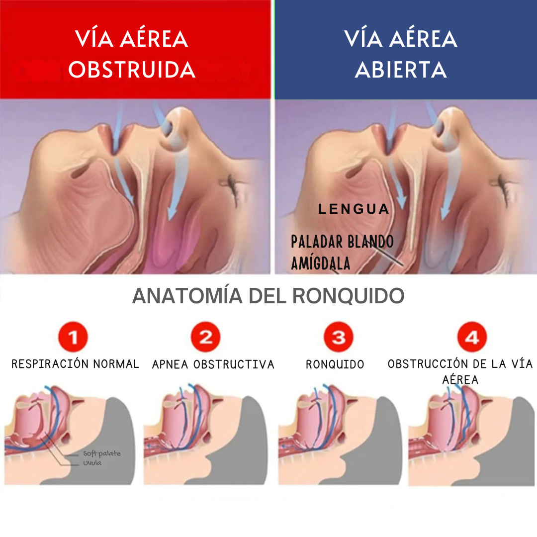 DormiPro® Bucal Antironquidos - Elimine sus Ronquidos