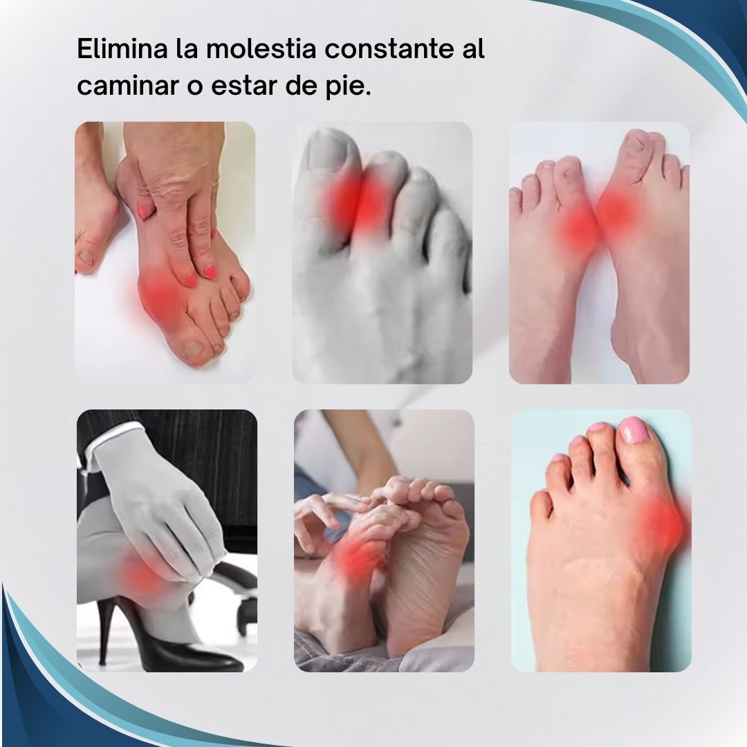 Corrector ortopédico ajustable para juanetes